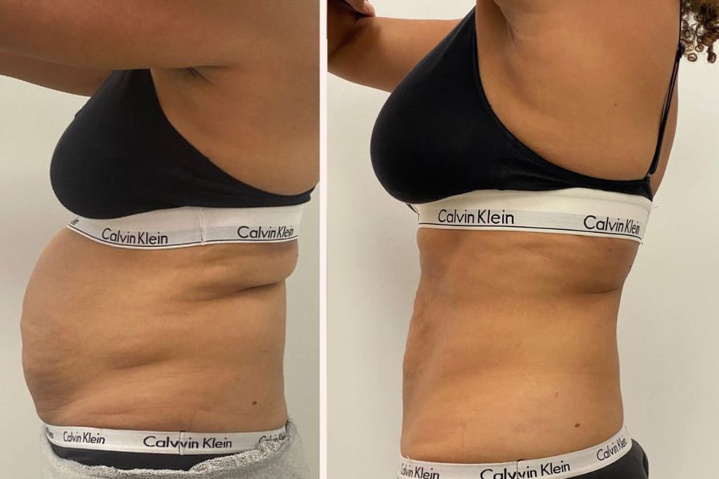 Snatched Waist Package